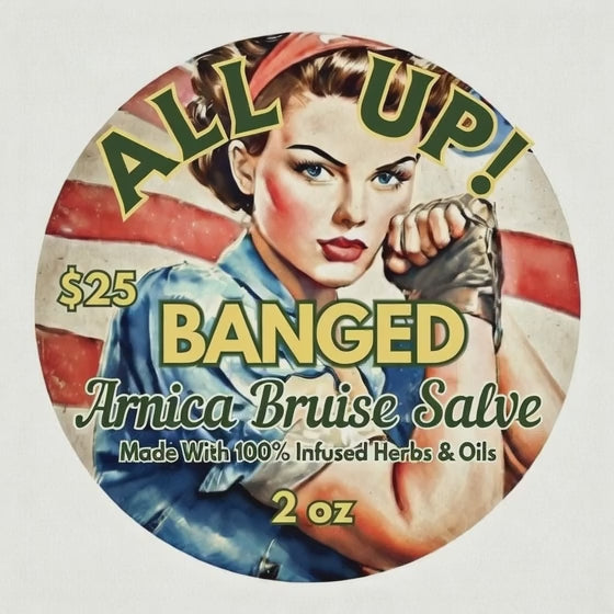 All Banged Up! – Signature Arnica Bruise & Drawing Salve (2 oz Silver Tin) – 100% Handmade by Certified Herbalist